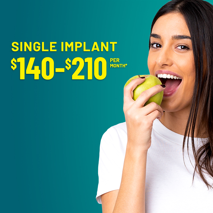 Implant offer banner